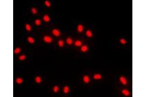 Immunofluorescence (IF) image for anti-BTB and CNC Homology 1, Basic Leucine Zipper Transcription Factor 1 (BACH1) (Center) antibody (ABIN7294994)