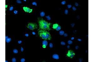Image no. 4 for anti-Carboxypeptidase A2 (Pancreatic) (CPA2) antibody (ABIN1497595) (Carboxypeptidase A2 Antikörper)