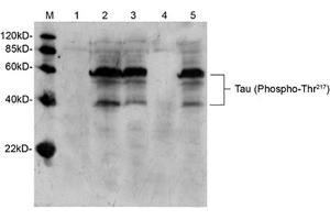 Western blot analysis of mouse brain tissue lysate using Rabbit Anti-Tau (Phospho-Thr217) Polyclonal Antibody (ABIN398308) Lane 1: Primary antibody negative controlLane 2: Rabbit Anti-Tau (Phospho-Thr217) Polyclonal AntibodyLane 3: Rabbit Anti-Tau (Phospho-Thr217) Polyclonal Antibody pre-incubated with non-phoshpo-peptideLane 4: Rabbit Anti-Tau (Phospho-Thr217) Polyclonal Antibody pre-incubated with phoshpo-peptideLane 5: Rabbit Anti-Tau (Phospho-Thr217) Polyclonal Antibody pre-incubated with generic phospho-threonine containing peptideSecondary antibody: Goat Anti-Rabbit IgG (H&L) [HRP] Polyclonal Antibody (ABIN398323) The signal was developed with LumiSensorTM HRP Substrate Kit (ABIN769939) (tau Antikörper  (pThr217))