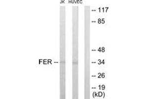 Western blot analysis of extracts from Jurkat/HuvEc cells, using FER Antibody. (FER Antikörper  (AA 766-815))