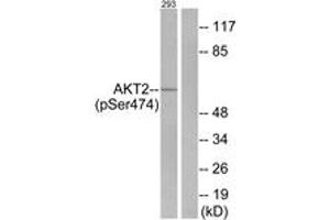 Western blot analysis of extracts from 293 cells treated with EGF 200ng/ml 30', using Akt2 (Phospho-Ser474) Antibody. (AKT2 Antikörper  (pSer474))