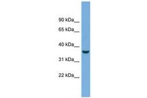 Image no. 1 for anti-Crystallin, mu (CRYM) (AA 71-120) antibody (ABIN6743607) (CRYM Antikörper  (AA 71-120))