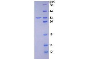SDS-PAGE analysis of Human HABP1 Protein. (C1QBP Protein)