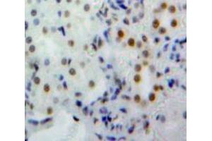 Used in DAB staining on fromalin fixed paraffin-embedded Kidney tissue (NUP160 Antikörper  (AA 11-206))