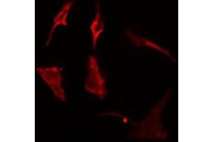 ABIN6275088 staining  Hela cells by IF/ICC.