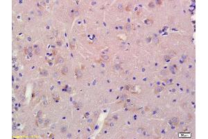 Formalin-fixed and paraffin embedded rat brain labeled with Anti-CNGA2 Polyclonal Antibody, Unconjugated (ABIN677258) at 1:200, followed by conjugation to the secondary antibody and DAB staining