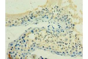 Immunohistochemistry of paraffin-embedded human testis tissue using ABIN7154927 at dilution of 1:100 (HSPA2 Antikörper  (AA 400-639))