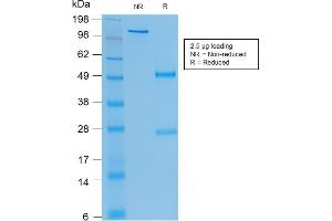SDS-PAGE Analysis Purified CEA Mouse Recombinant Monoclonal Antibody (rC66/1009). (Rekombinanter CEACAM5 Antikörper)