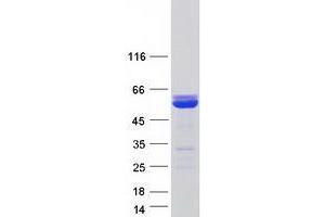 Western Blotting (WB) image for X-Ray Repair Complementing Defective Repair in Chinese Hamster Cells 4 (XRCC4) (Transcript Variant 1) protein (Myc-DYKDDDDK Tag) (ABIN2735697)