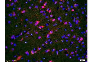 Immunofluorescence (IF) image for anti-Calcium Channel, Voltage-Dependent, T Type, alpha 1G Subunit (CACNA1G) (AA 901-1000) antibody (ABIN680608)