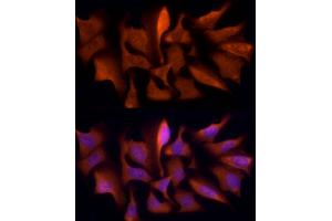 Immunofluorescence analysis of U2OS cells using PSMC5 Rabbit mAb (ABIN7269585) at dilution of 1:50 (40x lens). (PSMC5 Antikörper)