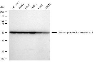 Western blotting analysis using Cholinergic receptor muscarinic 2 antibody (ABIN7798054).