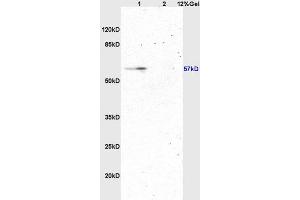 Lane 1: rat brain lysates Lane 2: rat kidney lysates probed with Anti ATG13 Polyclonal Antibody, Unconjugated (ABIN750313) at 1:200 in 4 °C. (ATG13 Antikörper  (AA 51-150))