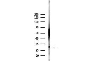 anti-Electron-Transfer-Flavoprotein, beta Polypeptide (ETFB) (Internal Region) antibody