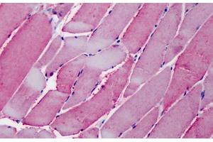 Human Skeletal Muscle: Formalin-Fixed, Paraffin-Embedded (FFPE) (OSBPL1A Antikörper  (AA 938-950))