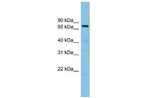 AKAP10 antibody used at 1 ug/ml to detect target protein. (AKAP10 Antikörper)