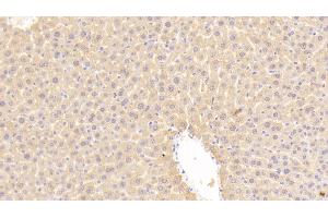Detection of LDLR in Mouse Liver Tissue using Polyclonal Antibody to Low Density Lipoprotein Receptor (LDLR) (LDLR Antikörper  (AA 263-509))