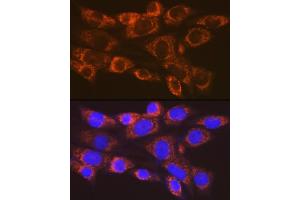 Immunofluorescence analysis of NIH-3T3 cells using  Rabbit mAb (ABIN7265479) at dilution of 1:100 (40x lens). (ARF1 Antikörper)
