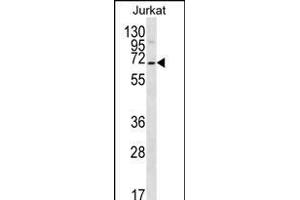 PSL1 Antibody (N-term) 12400a western blot analysis in Jurkat cell line lysates (35 μg/lane).