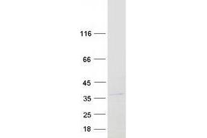 Validation with Western Blot (LRRC10 Protein (Myc-DYKDDDDK Tag))
