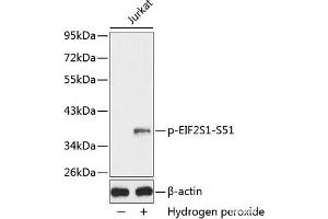 Western blot analysis of extracts from Jurkat cells using Phospho-eIF2α(S51) Polyclonal Antibody. (EIF2A Antikörper  (pSer51))