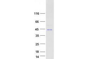 Western Blotting (WB) image for Nuclear Factor of kappa Light Polypeptide Gene Enhancer in B-Cells Inhibitor, alpha (NFKBIA) protein (Myc-DYKDDDDK Tag) (ABIN2727229)