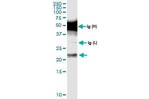 Immunoprecipitation of CENPN transfected lysate using anti-CENPN MaxPab rabbit polyclonal antibody and Protein A Magnetic Bead , and immunoblotted with CENPN MaxPab rabbit polyclonal antibody (D01) . (CENPN Antikörper  (AA 1-204))
