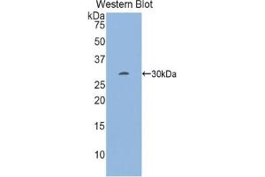 Detection of Recombinant EGR2, Mouse using Polyclonal Antibody to Early Growth Response Protein 2 (EGR2) (EGR2 Antikörper  (AA 150-407))