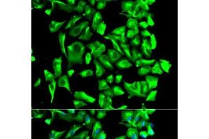Immunofluorescence analysis of U2OS cells using HSP90AB1 Polyclonal Antibody (HSP90AB1 Antikörper)