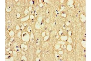 Immunohistochemistry of paraffin-embedded human brain tissue using ABIN7168091 at dilution of 1:100 (Riboflavin Kinase Antikörper  (AA 1-154))