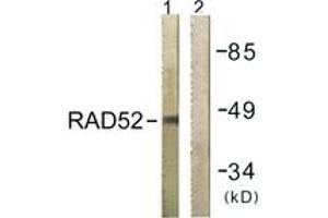 Western blot analysis of extracts from 293 cells, using RAD52 (Ab-104) Antibody. (RAD52 Antikörper  (AA 70-119))