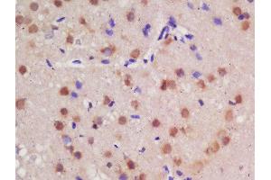 Formalin-fixed and paraffin embedded rat brain labeled with Rabbit Anti-Guanylyl Cyclase alpha 1 Polyclonal Antibody, Unconjugated  at 1:200 followed by conjugation to the secondary antibody and DAB staining