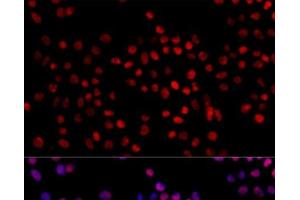 Immunofluorescence analysis of 293T cells using XRCC4 Polyclonal Antibody at dilution of 1:100. (XRCC4 Antikörper)