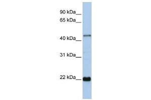 Western Blotting (WB) image for anti-Zinc Finger Protein 581 (ZNF581) antibody (ABIN2458185) (ZNF581 Antikörper)