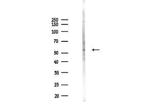 Western blot analysis of lysates from HUVEC cells(UV,30 min treatment), using Phospho-RUNX1 / AML1 (Ser304) Antibody at 1/1000 dilution.