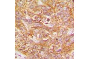 Immunohistochemistry (IHC) image for anti-V-Yes-1 Yamaguchi Sarcoma Viral Related Oncogene Homolog (LYN) (C-Term) antibody (ABIN7302724)