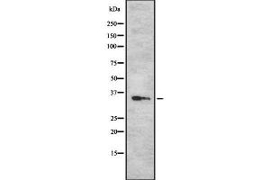Western blot analysis Sarcoglycan-β using Jurkat whole cell lysates (SGCB Antikörper  (N-Term))