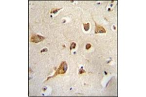 Formalin Fixed, Paraffin Embedded Human brain tissue stained with Kif5C-2 Antibody followed by peroxidase conjugation of the secondary antibody and DAB staining.