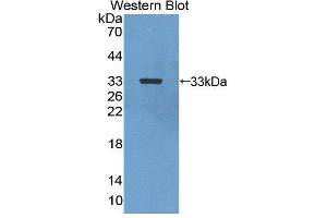 Western blot analysis of the recombinant protein. (CA13 Antikörper  (AA 1-262))