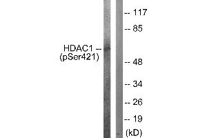Western blot analysis of extracts from Jurkat cells, treated with EGF (200ng/ml, 30mins), using HDAC1 (Phospho-Ser421) antibody. (HDAC1 Antikörper  (pSer421))