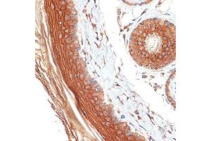 Immunohistochemistry of paraffin-embedded rat skin using PERP Rabbit mAb (ABIN7270861) at dilution of 1:100 (40x lens). (PERP Antikörper)