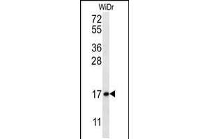 Western blot analysis in WiDr cell line lysates (35ug/lane). (TBCA Antikörper  (N-Term))