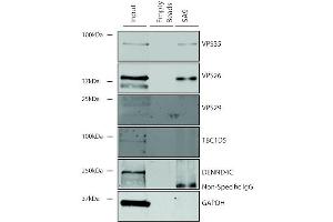 Immunoprecipitation analysis using Mouse Anti-VPS35 Monoclonal Antibody, Clone 5A9 (ABIN6932951). (VPS35 Antikörper  (HRP))