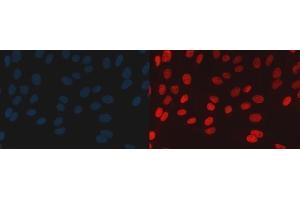 IF analysis of BAF57/SMARCE1 using anti-BAF57/SMARCE1 antibody (ABIN7600326).