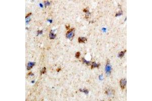 Immunohistochemical analysis of SKIP staining in rat brain formalin fixed paraffin embedded tissue section. (SKIP Antikörper)