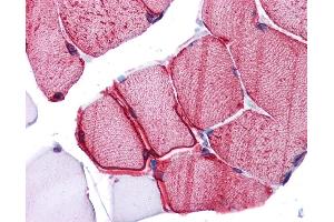 Immunohistochemistry (IHC) image for anti-Wingless-Type MMTV Integration Site Family, Member 5B (WNT5B) (Middle Region) antibody (ABIN2776725) (WNT5B Antikörper  (Middle Region))