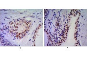 Immunohistochemistry (IHC) image for anti-NK3 Homeobox 1 (NKX3-1) antibody (ABIN969316)