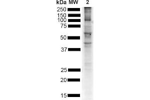Western Blot analysis of Mouse Brain showing detection of Alpha Synuclein pSer129 protein using Rabbit Anti-Alpha Synuclein pSer129 Monoclonal Antibody, Clone J18 (ABIN6932878). (SNCA Antikörper  (pSer129) (FITC))
