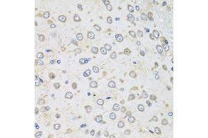 Immunohistochemistry of paraffin-embedded rat brain using Albumin antibody (ABIN3020953, ABIN3020954, ABIN3020955 and ABIN6213817) at dilution of 1:100 (40x lens). (Albumin Antikörper  (AA 20-255))