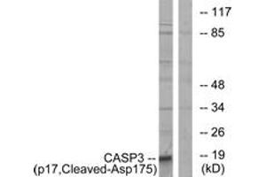 Western blot analysis of extracts from COLO cells, using Caspase 3 (p17,Cleaved-Asp175) Antibody. (Caspase 3 Antikörper  (Cleaved-Asp175))